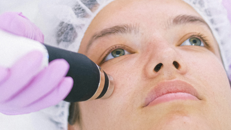 Choosing the Top Clinic for Laser Anti-Aging in Arlington, VA